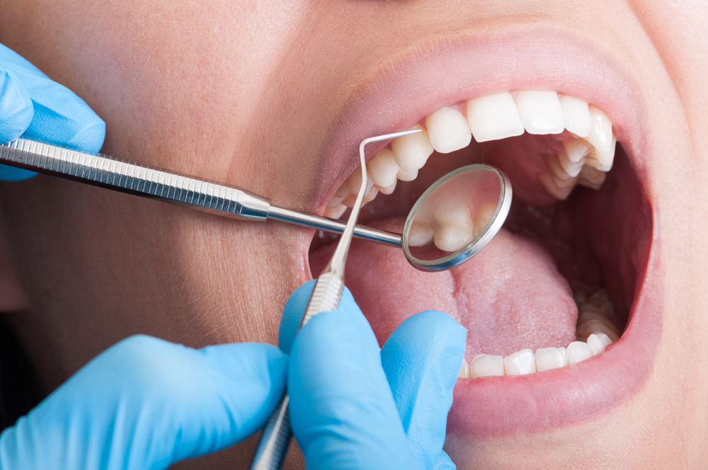 dental cleaning porcedure